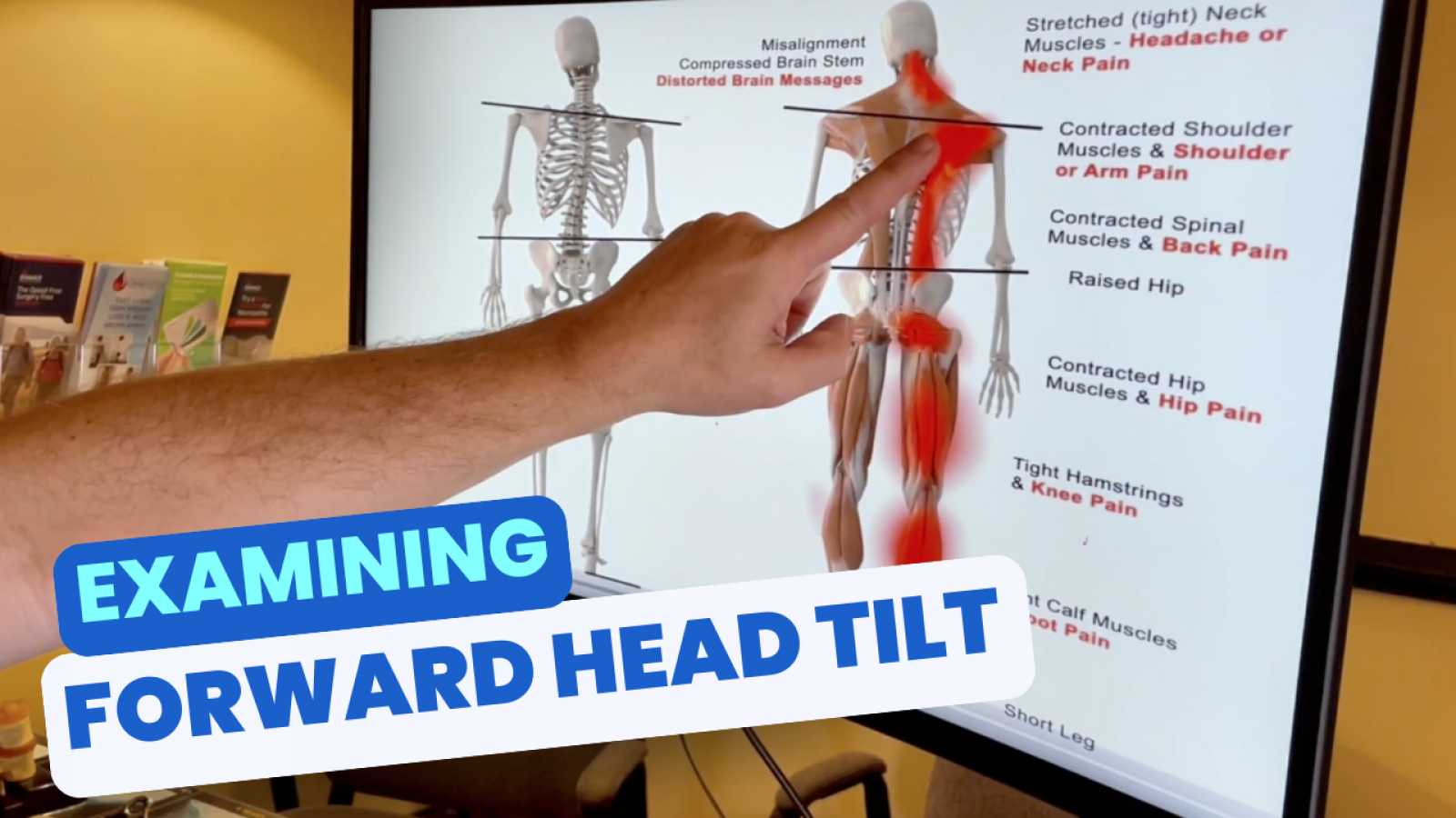 Lexington YT Thumbs (8)